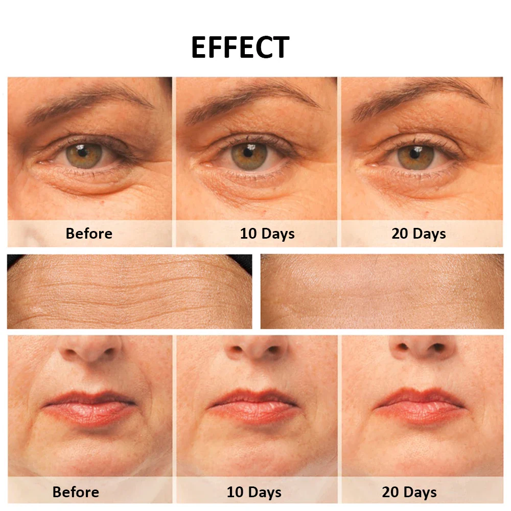 EMS Microcurrent Face Lifting & Anti-Ageing Facial Massager - Image 6